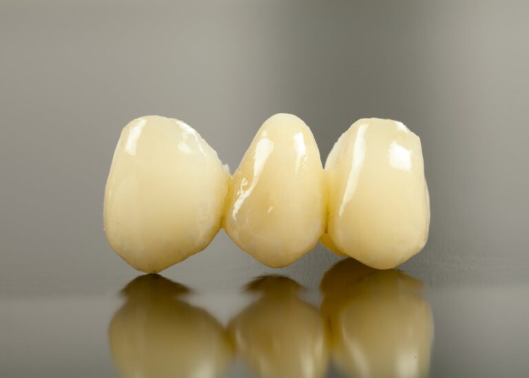 Caps & Tooth Replacement