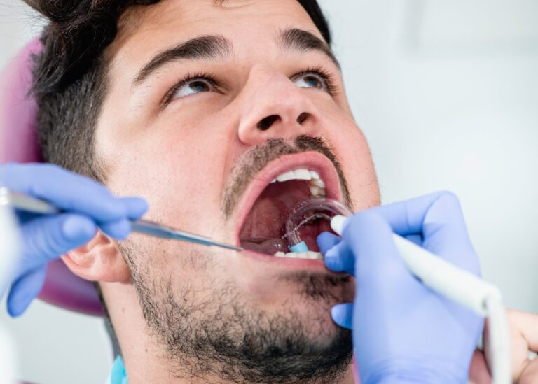 Teeth Cleaning